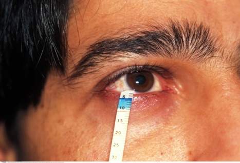Ojo seco y alergia ocular. Las mejores lágrimas artificiales para ojo seco